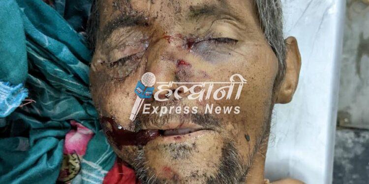 ब्रेकिंग न्यूज़: सड़क दुर्घटना में अधेड़ की मौत, शिनाख्त के लिए पुलिस ने की अपील