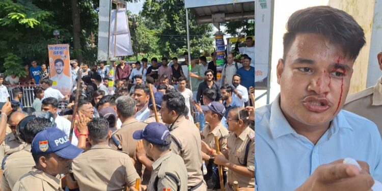 हल्द्वानी छात्र संघ चुनाव: फर्जी वोटिंग, झड़प और हंगामे के बीच संपन्न हुआ मतदान